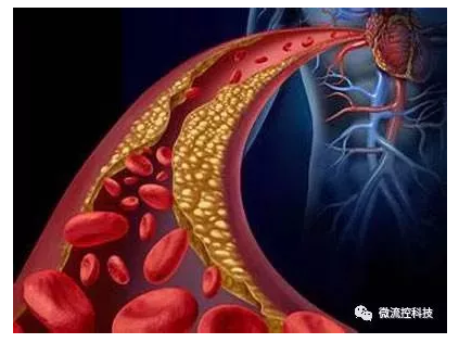 微流控芯片技术在心血管疾病中的应用