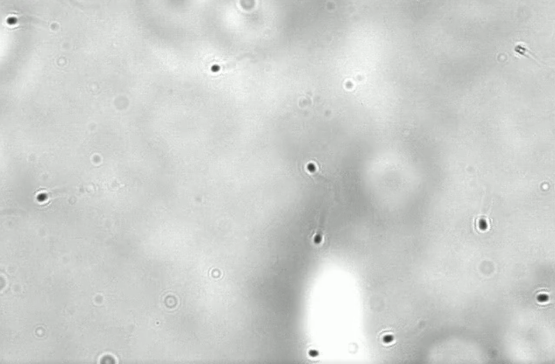 该图片演示了精子对流动的能力。流动是从左到右，你看到一些精子开始抵抗和游泳。图片来源：Afrouz Ataei在她的顾问（Waseem Asghar）实验室的设备上